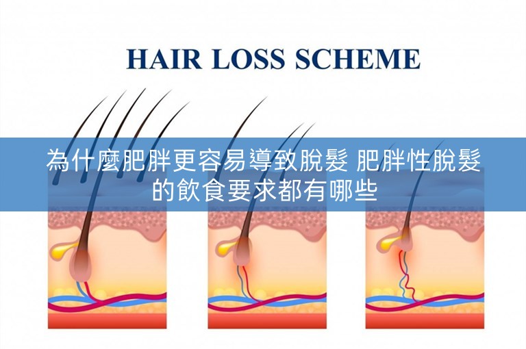 為什麼肥胖更容易導致脫髮 肥胖性脫髮的飲食要求都有哪些