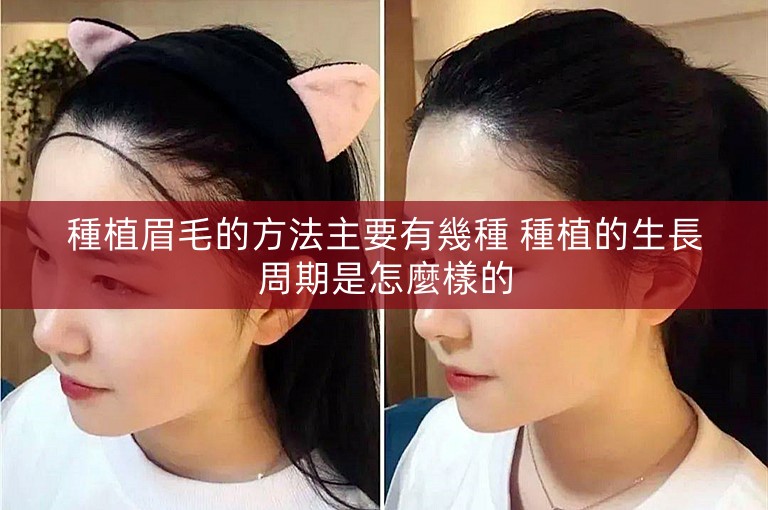 種植眉毛的方法主要有幾種 種植的生長周期是怎麼樣的