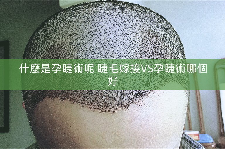 什麼是孕睫術呢 睫毛嫁接VS孕睫術哪個好 什麼是孕睫術呢 睫毛嫁接VS孕睫術哪個好