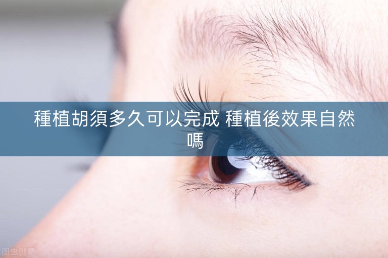 種植胡須多久可以完成 種植後效果自然嗎 種植胡須多久可以完成 種植後效果自然嗎
