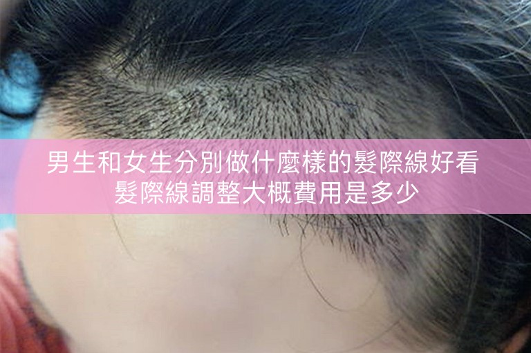 男生和女生分別做什麼樣的髮際線好看 髮際線調整大概費用是多少