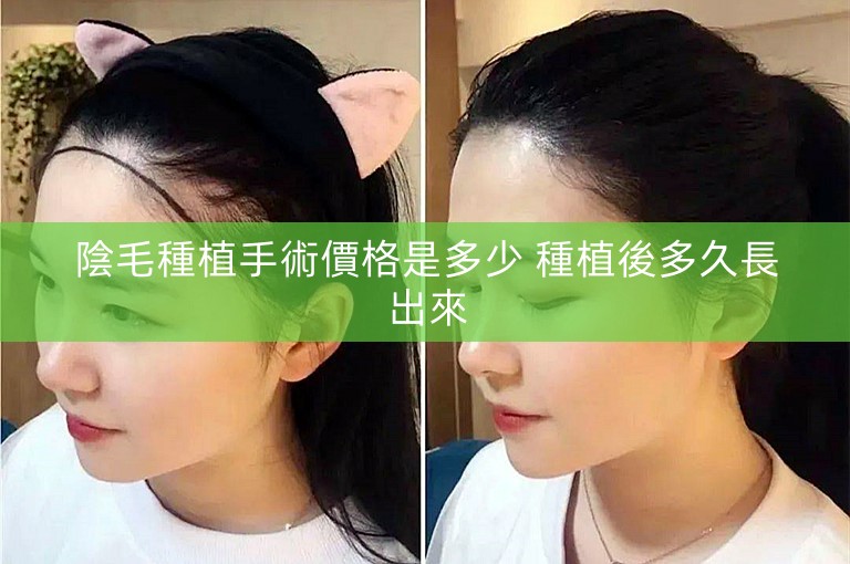 陰毛種植手術價格是多少 種植後多久長出來