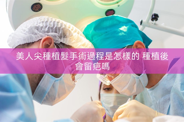 美人尖種植髮手術過程是怎樣的 種植後會留疤嗎