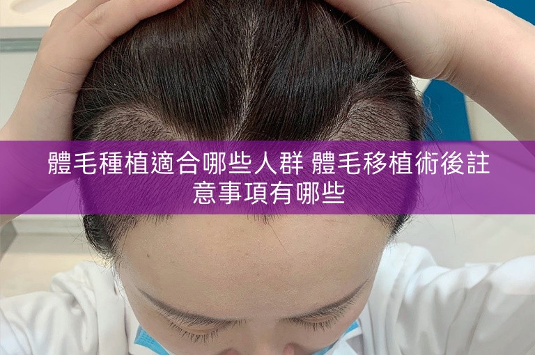 體毛種植適合哪些人群 體毛移植術後註意事項有哪些