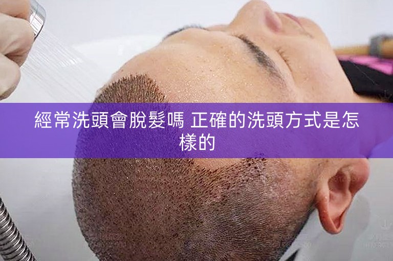 經常洗頭會脫髮嗎 正確的洗頭方式是怎樣的 經常洗頭會脫髮嗎 正確的洗頭方式是怎樣的