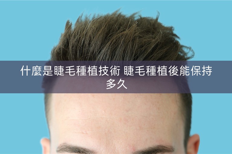 什麼是睫毛種植技術 睫毛種植後能保持多久