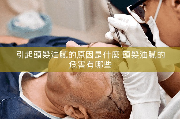 引起頭髮油膩的原因是什麼 頭髮油膩的危害有哪些