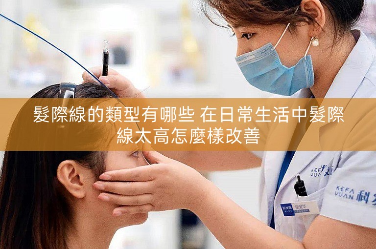 髮際線的類型有哪些 在日常生活中髮際線太高怎麼樣改善