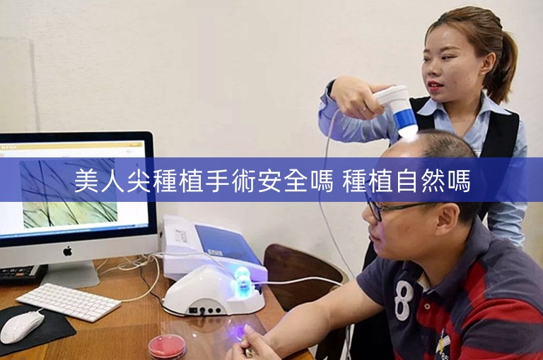 美人尖種植手術安全嗎 種植自然嗎