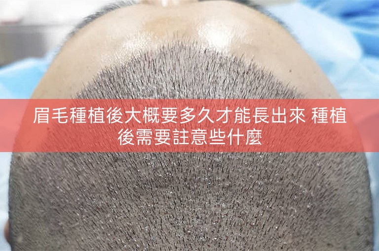 眉毛種植後大概要多久才能長出來 種植後需要註意些什麼