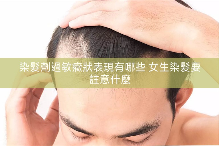 染髮劑過敏癥狀表現有哪些 女生染髮要註意什麼