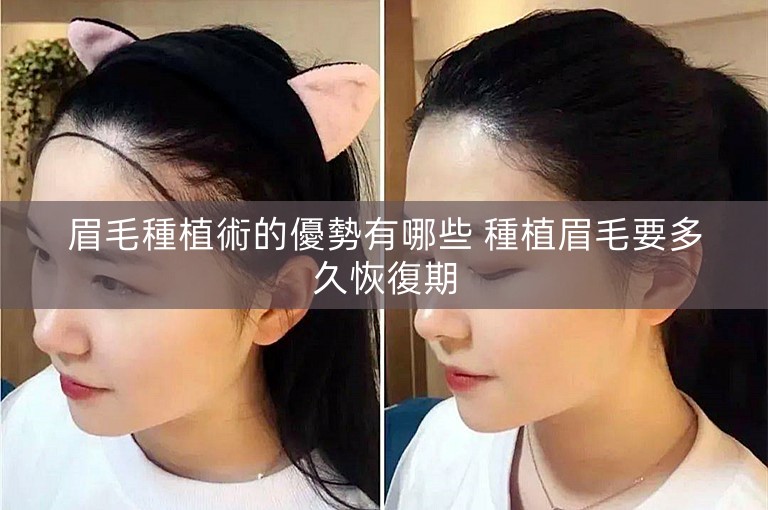 眉毛種植術的優勢有哪些 種植眉毛要多久恢復期