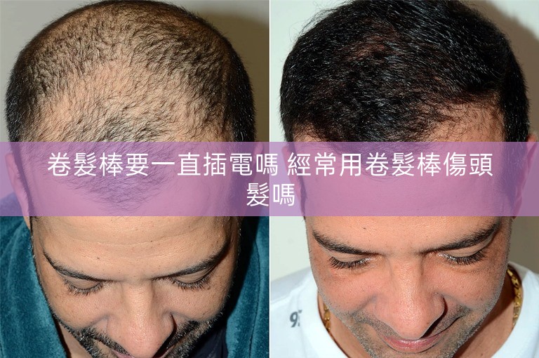 卷髮棒要一直插電嗎 經常用卷髮棒傷頭髮嗎