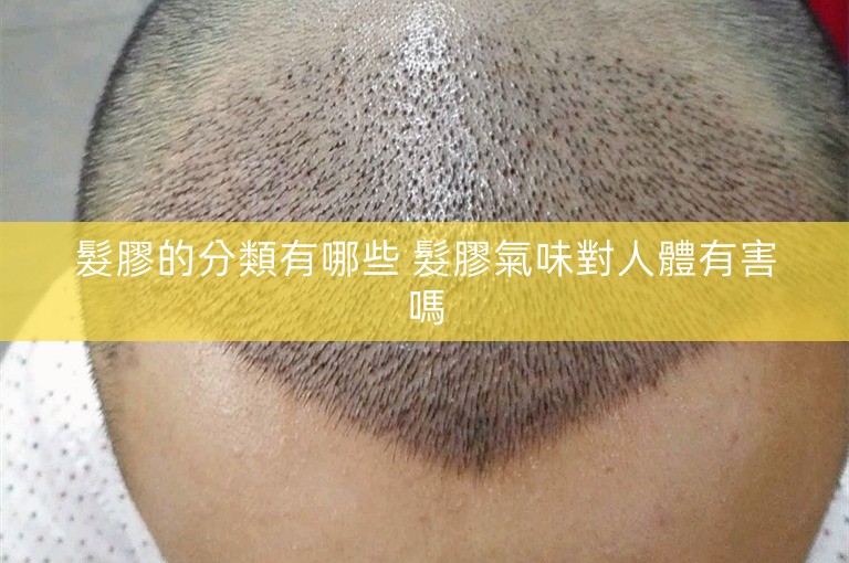 髮膠的分類有哪些 髮膠氣味對人體有害嗎