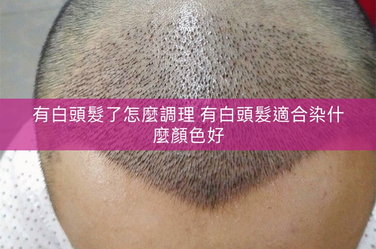 有白頭髮了怎麼調理 有白頭髮適合染什麼顏色好
