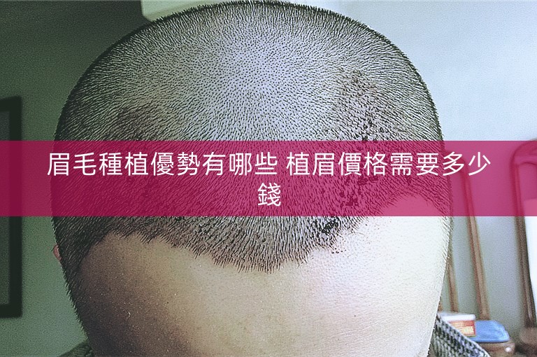 眉毛種植優勢有哪些 植眉價格需要多少錢