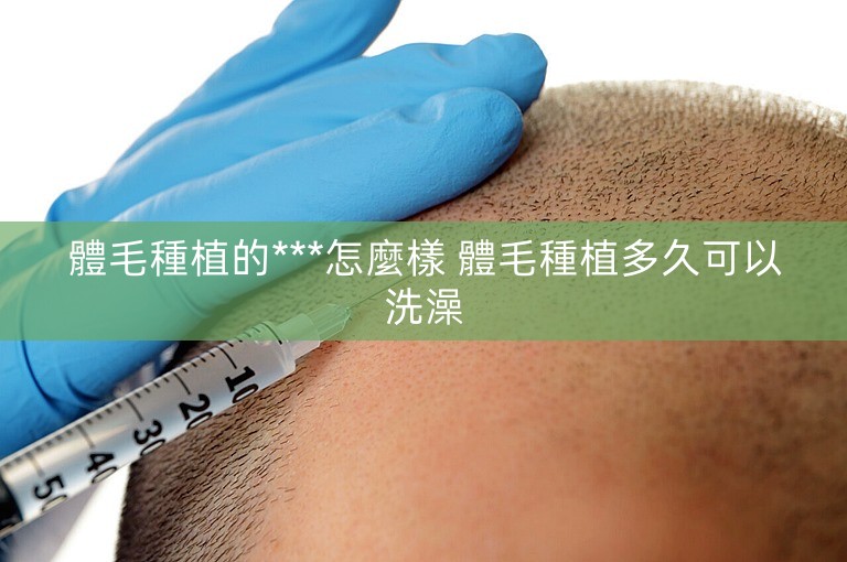 體毛種植的***怎麼樣 體毛種植多久可以洗澡
