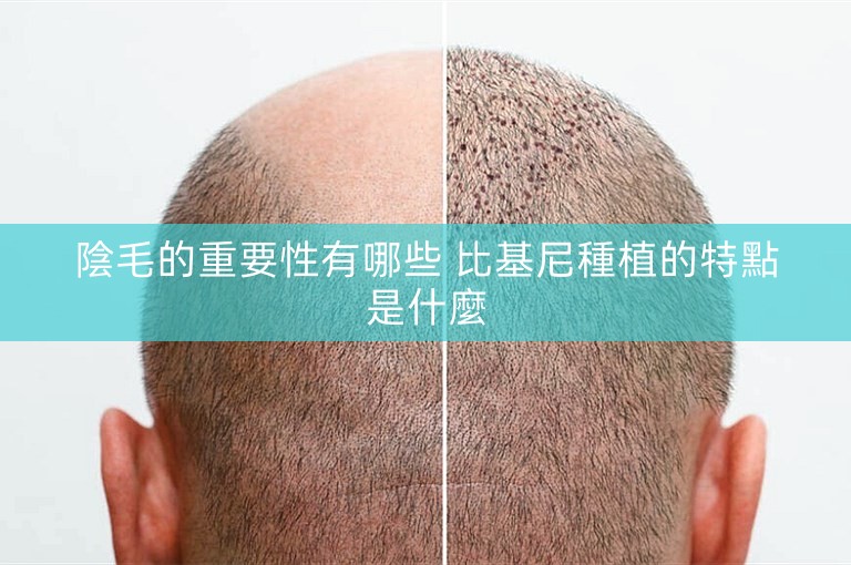 陰毛的重要性有哪些 比基尼種植的特點是什麼