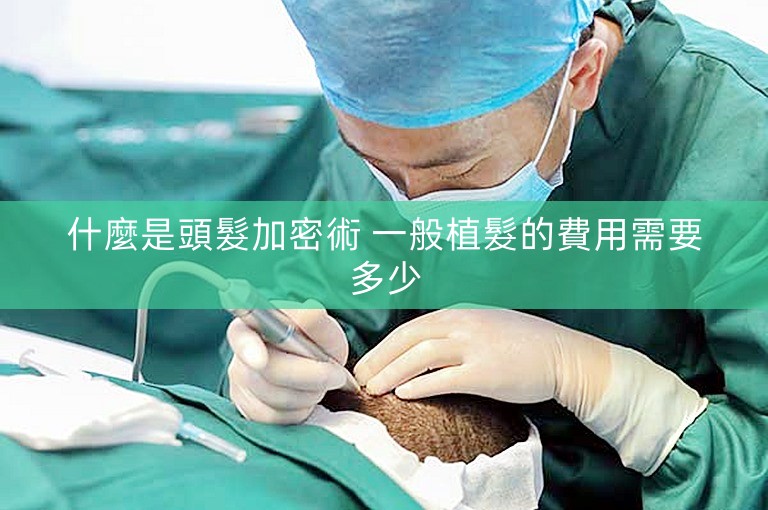什麼是頭髮加密術 一般植髮的費用需要多少
