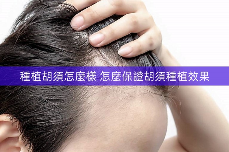 種植胡須怎麼樣 怎麼保證胡須種植效果