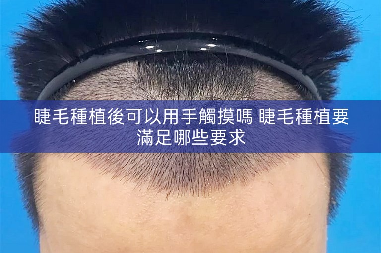 睫毛種植後可以用手觸摸嗎 睫毛種植要滿足哪些要求