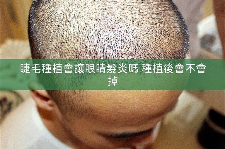 睫毛種植會讓眼睛髮炎嗎 種植後會不會掉