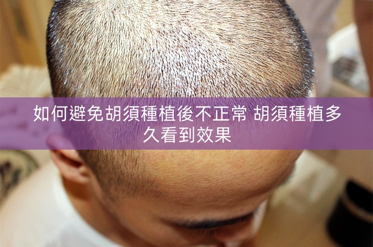 如何避免胡須種植後不正常 胡須種植多久看到效果