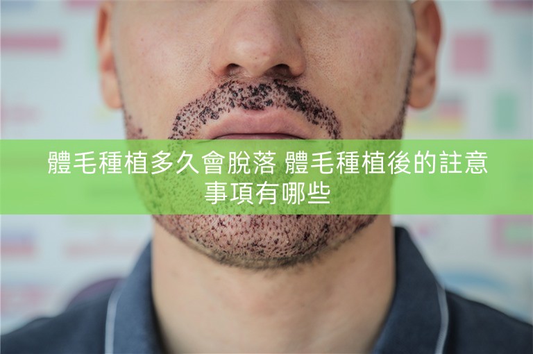 體毛種植多久會脫落 體毛種植後的註意事項有哪些