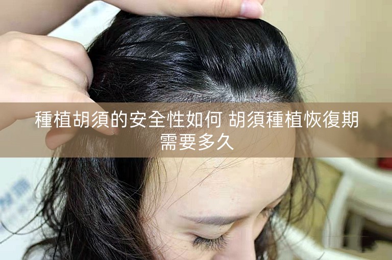 種植胡須的安全性如何 胡須種植恢復期需要多久