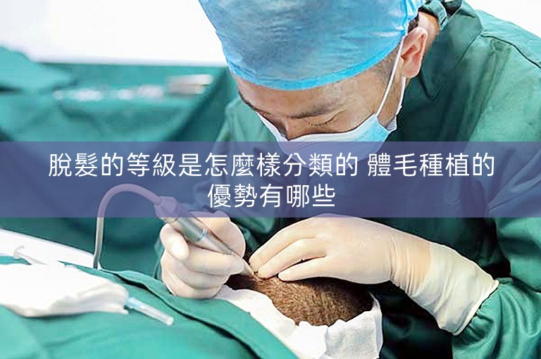 脫髮的等級是怎麼樣分類的 體毛種植的優勢有哪些