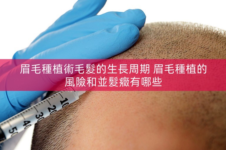 眉毛種植術毛髮的生長周期 眉毛種植的風險和並髮癥有哪些