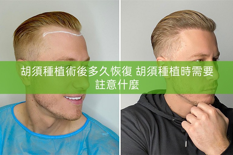 胡須種植術後多久恢復 胡須種植時需要註意什麼
