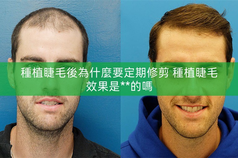 種植睫毛後為什麼要定期修剪 種植睫毛效果是**的嗎 種植睫毛後為什麼要定期修剪 種植睫毛效果是**的嗎