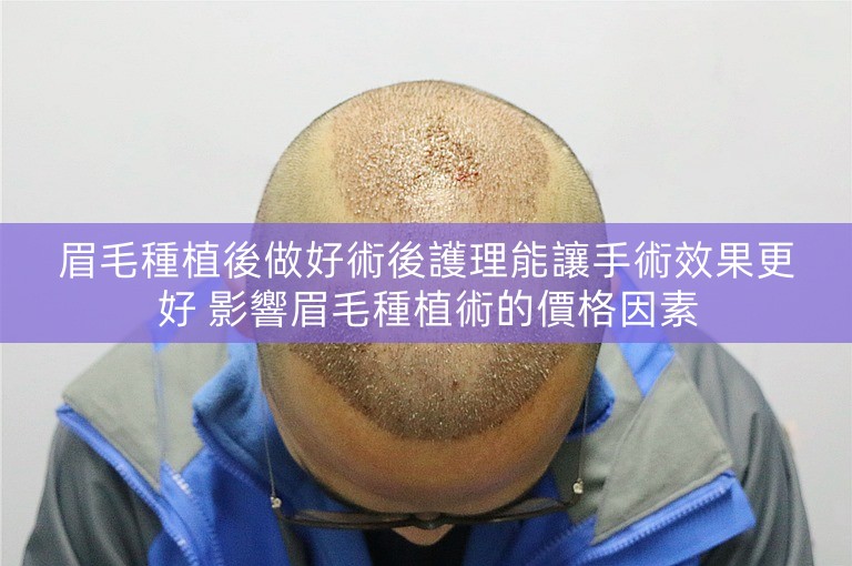 眉毛種植後做好術後護理能讓手術效果更好 影響眉毛種植術的價格因素