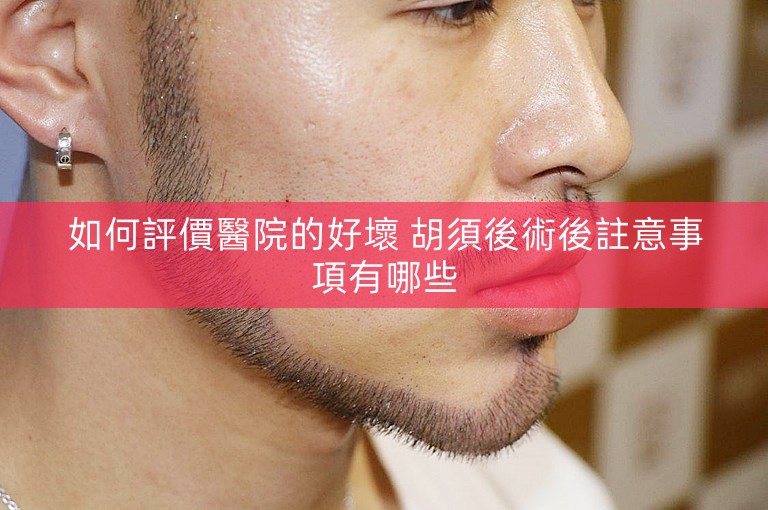 如何評價醫院的好壞 胡須後術後註意事項有哪些