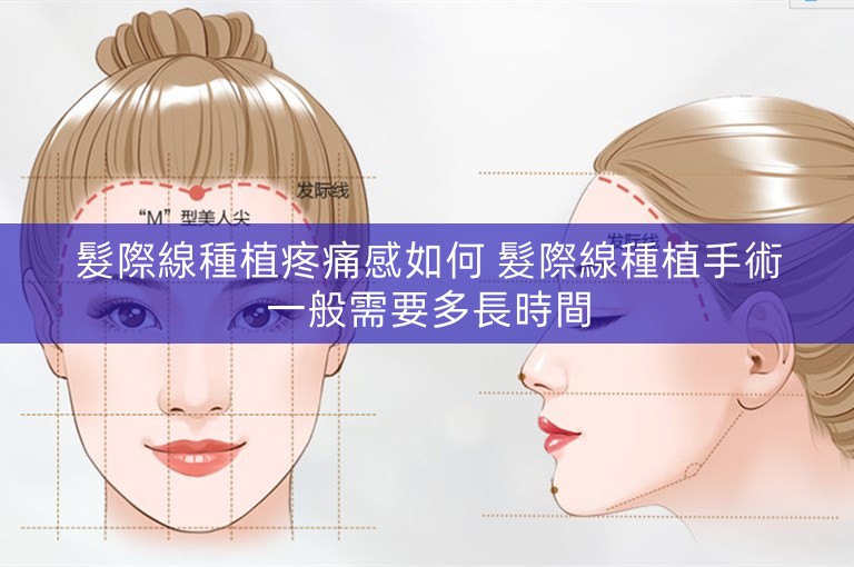 髮際線種植疼痛感如何 髮際線種植手術一般需要多長時間 髮際線種植疼痛感如何 髮際線種植手術一般需要多長時間