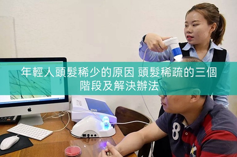 年輕人頭髮稀少的原因 頭髮稀疏的三個階段及解決辦法