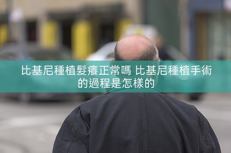 比基尼種植髮癢正常嗎 比基尼種植手術的過程是怎樣的