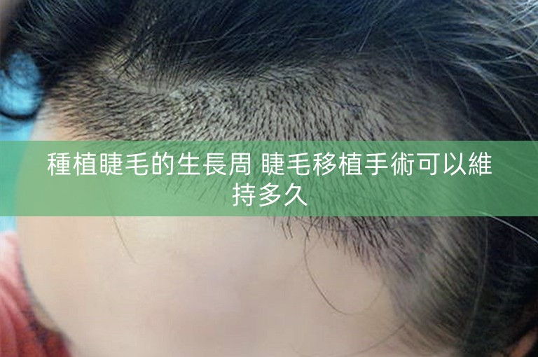 種植睫毛的生長周 睫毛移植手術可以維持多久