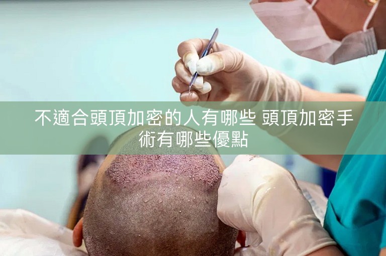 不適合頭頂加密的人有哪些 頭頂加密手術有哪些優點