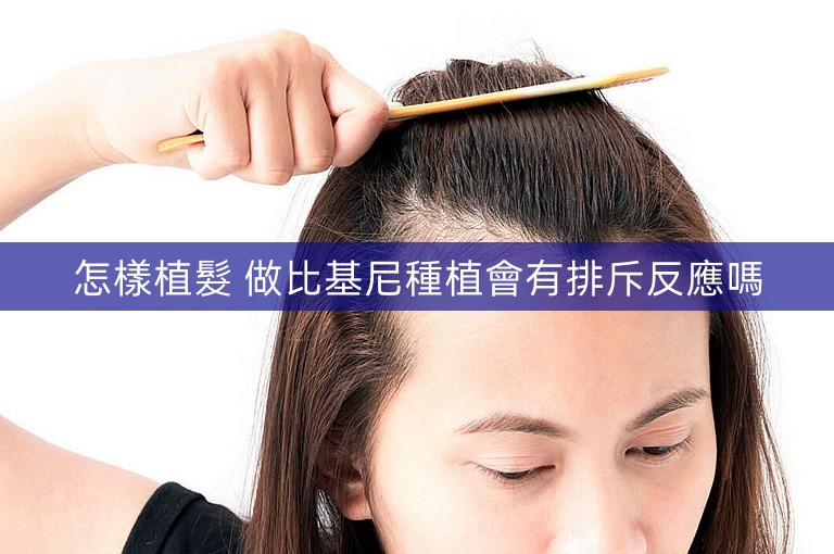 怎樣植髮 做比基尼種植會有排斥反應嗎