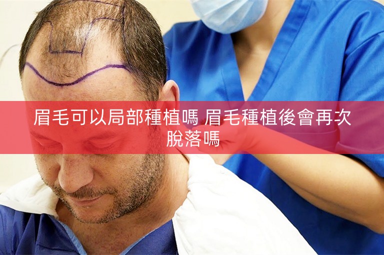 眉毛可以局部種植嗎 眉毛種植後會再次脫落嗎