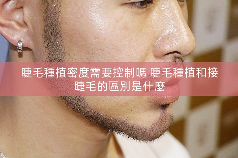 睫毛種植密度需要控制嗎 睫毛種植和接睫毛的區別是什麼