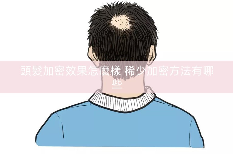 頭髮加密效果怎麼樣 稀少加密方法有哪些