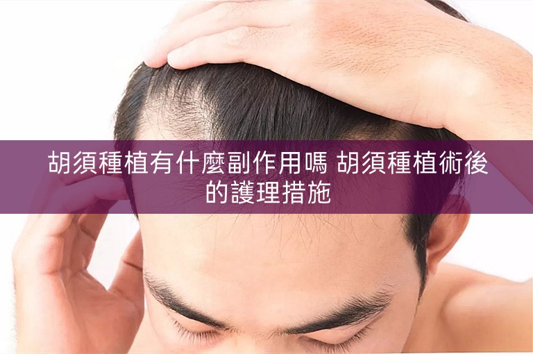 胡須種植有什麼副作用嗎 胡須種植術後的護理措施
