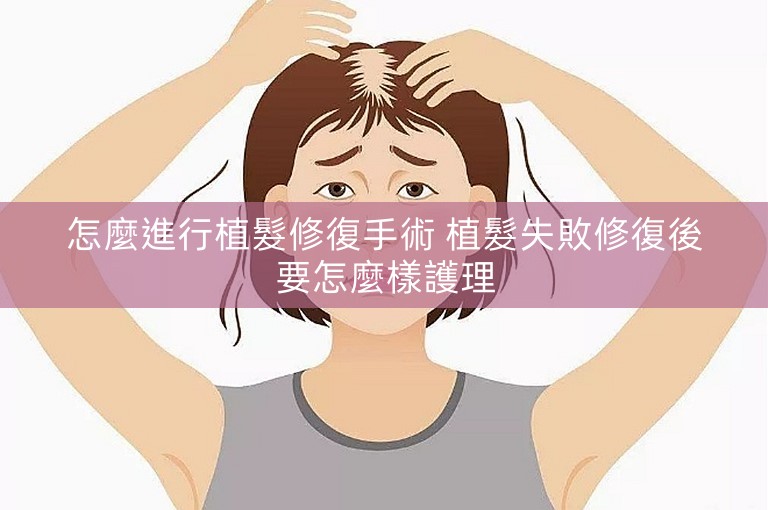 怎麼進行植髮修復手術 植髮失敗修復後要怎麼樣護理