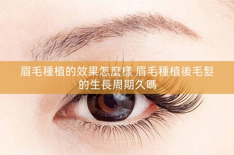 眉毛種植的效果怎麼樣 眉毛種植後毛髮的生長周期久嗎