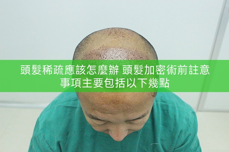 頭髮稀疏應該怎麼辦 頭髮加密術前註意事項主要包括以下幾點