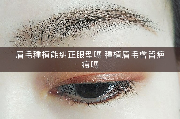 眉毛種植能糾正眼型嗎 種植眉毛會留疤痕嗎