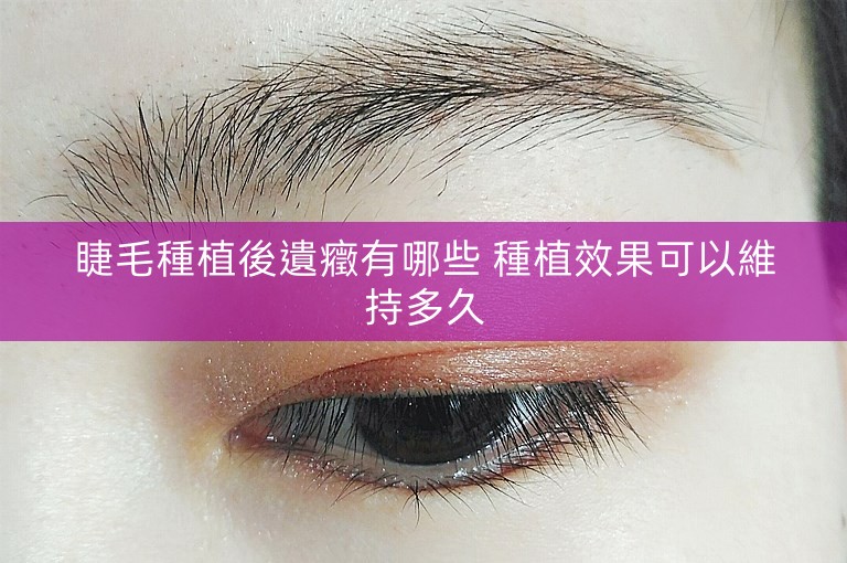 睫毛種植後遺癥有哪些 種植效果可以維持多久